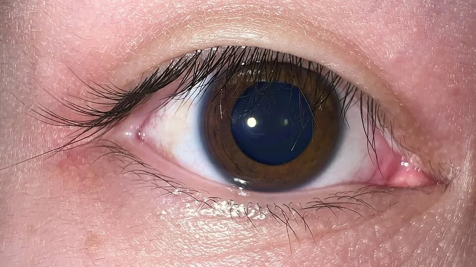 A close-up photograph of a human eye with a large dark pupil.